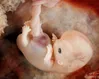 EU rules will ‘bring death’ to unborn