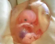 Abortion: Free speech & double-think