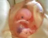 Abortion: Free speech & double-think