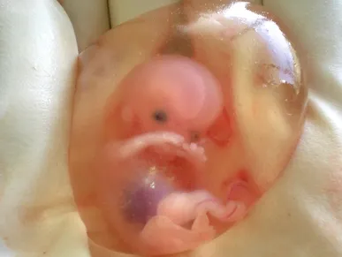 Abortion: Free speech & double-think