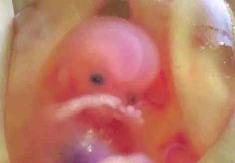 New ‘abortuary’ offers round the clock foetal killing