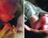 Decriminalising abortion  ‘profoundly irresponsible’