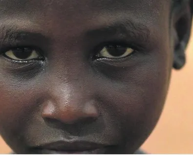 Sudan: Brutal civil war brings crisis in Nuba Mountains