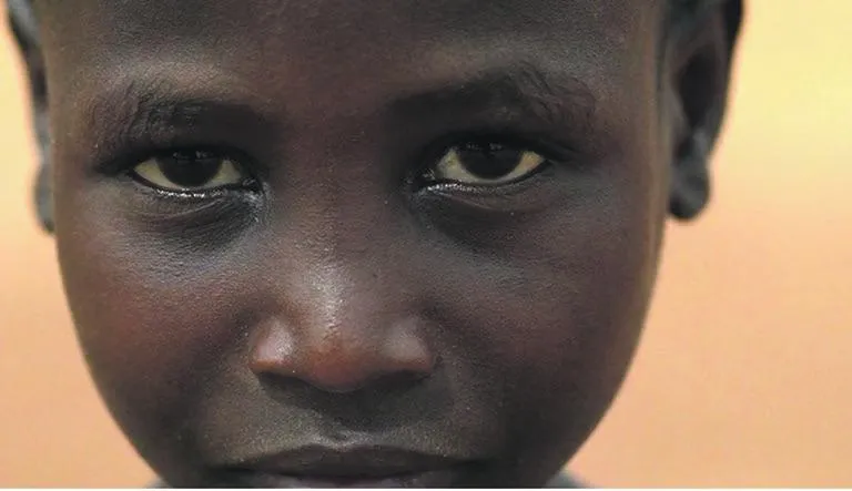 Sudan: Brutal civil war brings crisis in Nuba Mountains