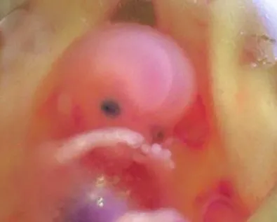 New ‘abortuary’ offers round the clock foetal killing